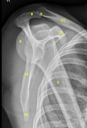 X-ray Left Scapula AP & LAT